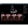 ECHOGRAPHE COULEUR 3D/4D ACLLRAIX LX28 + 1 SONDE