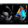 ECHOGRAPHE COULEUR 3D/4D ACLLRAIX LX28 + 1 SONDE