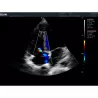 ECHOGRAPHE COULEUR 3D/4D ACLLRAIX LX28 + 1 SONDE