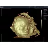 ECHOGRAPHE COULEUR 3D/4D ACLLRAIX LX28 + 1 SONDE