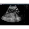 ECHOGRAPHE COULEUR 3D/4D ACLLRAIX LX28 + 1 SONDE