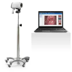 VIDÉO COLPOSCOPE C6A PIED ROULETTE STANDARD