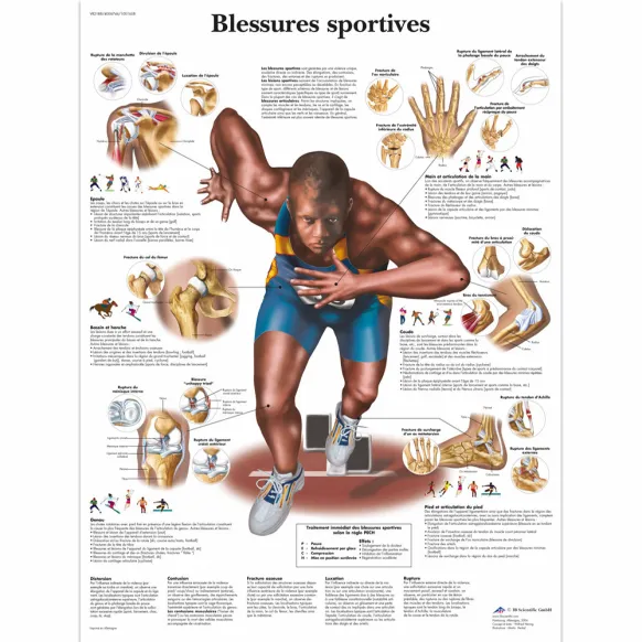 PLANCHES ANATOMIQUES BLESSURES SPORTIVES