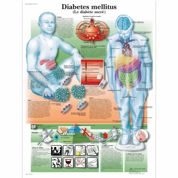 PLANCHES ANATOMIQUES LE DIABETE