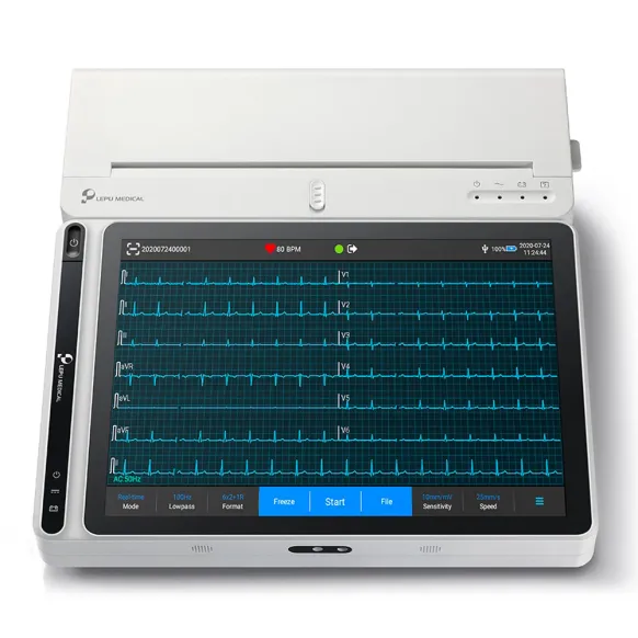 ECG 12 pistes avec interprétation complète | Technologies de l