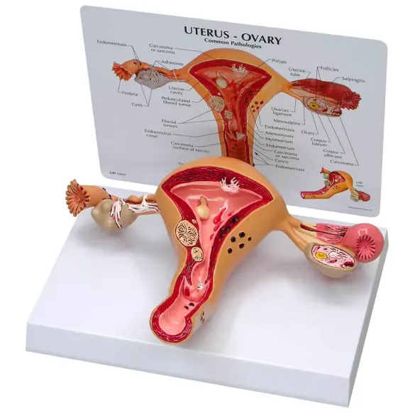 MODÈLE UTERUS ET OVAIRE SUR SOCLE