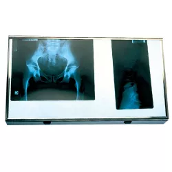 NÉGATOSCOPE