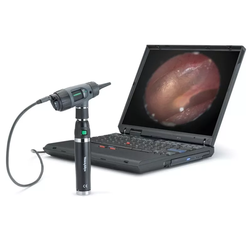 OTOSCOPE MACROVIEW DIGITAL WELCH-ALLYN