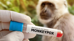 Variole du singe : symptômes, transmission, vaccin…